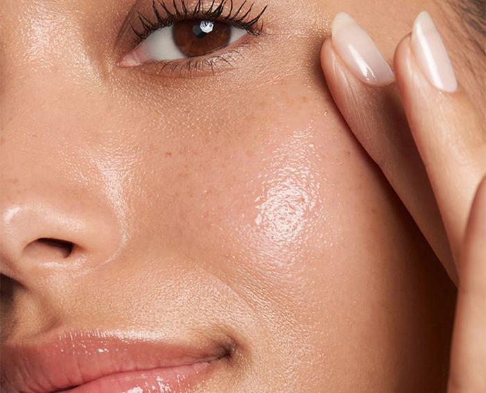 Acne and Blemish